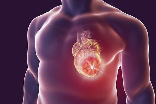 Reparando corazones: así se usa la terapia con células CAR-T contra el infarto agudo de miocardio