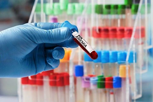 ¿Contribuyen la leche y los yogures a la anemia?