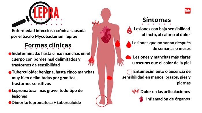 lepra1